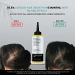 Cannazo India Advanced Hair Repair Oil – Ayurvedic Solution for Healthy Hair - Image 5