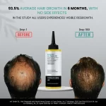 Cannazo India Advanced Hair Repair Oil – Ayurvedic Solution for Healthy Hair - Image 6