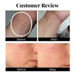 Cannazo India Daily Skin Repair Cream | All-in-One Day & Night Skincare for Men & Women - Image 5